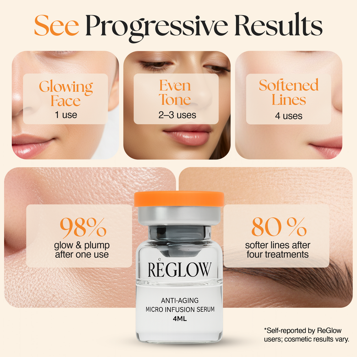 ReGlow Micro Infusion System