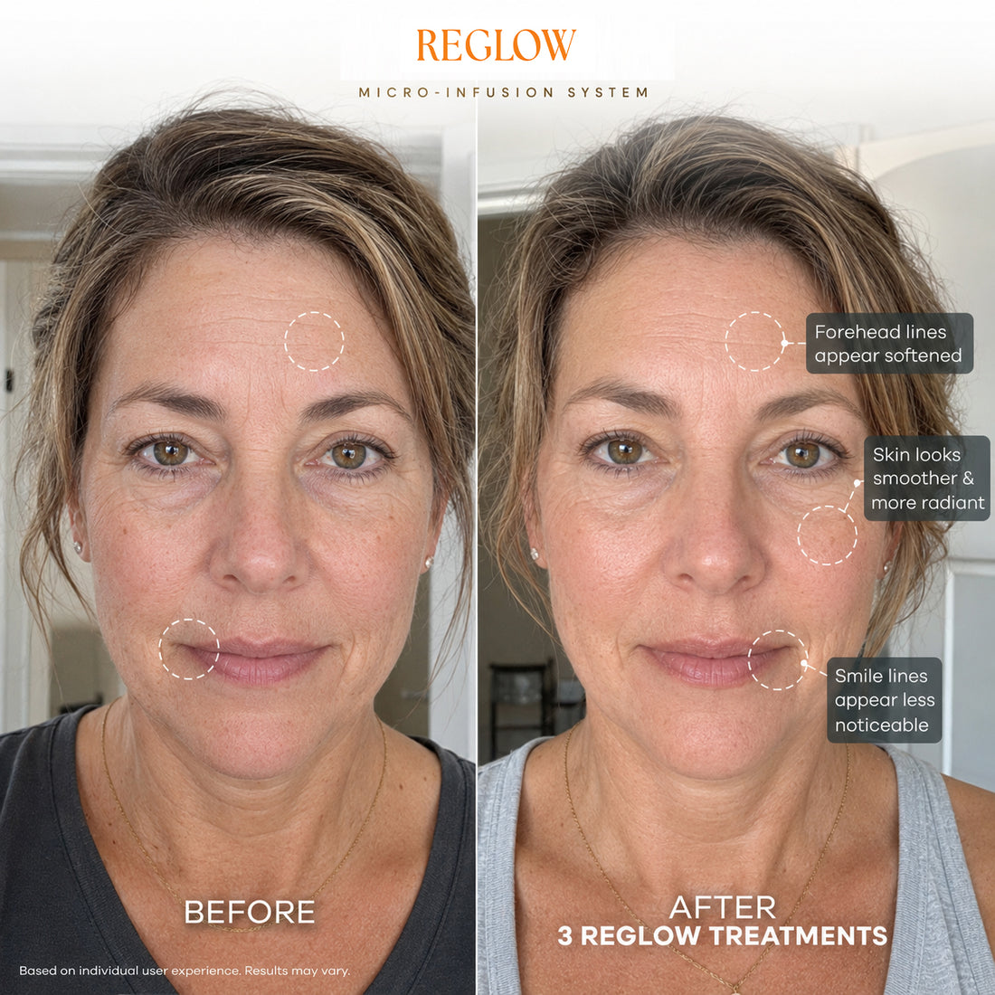 ReGlow facial skin appearance before and after from the US website