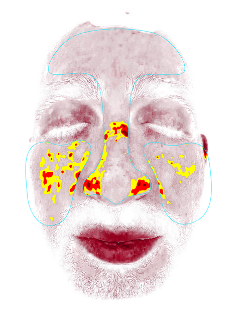 After Deep Scan
