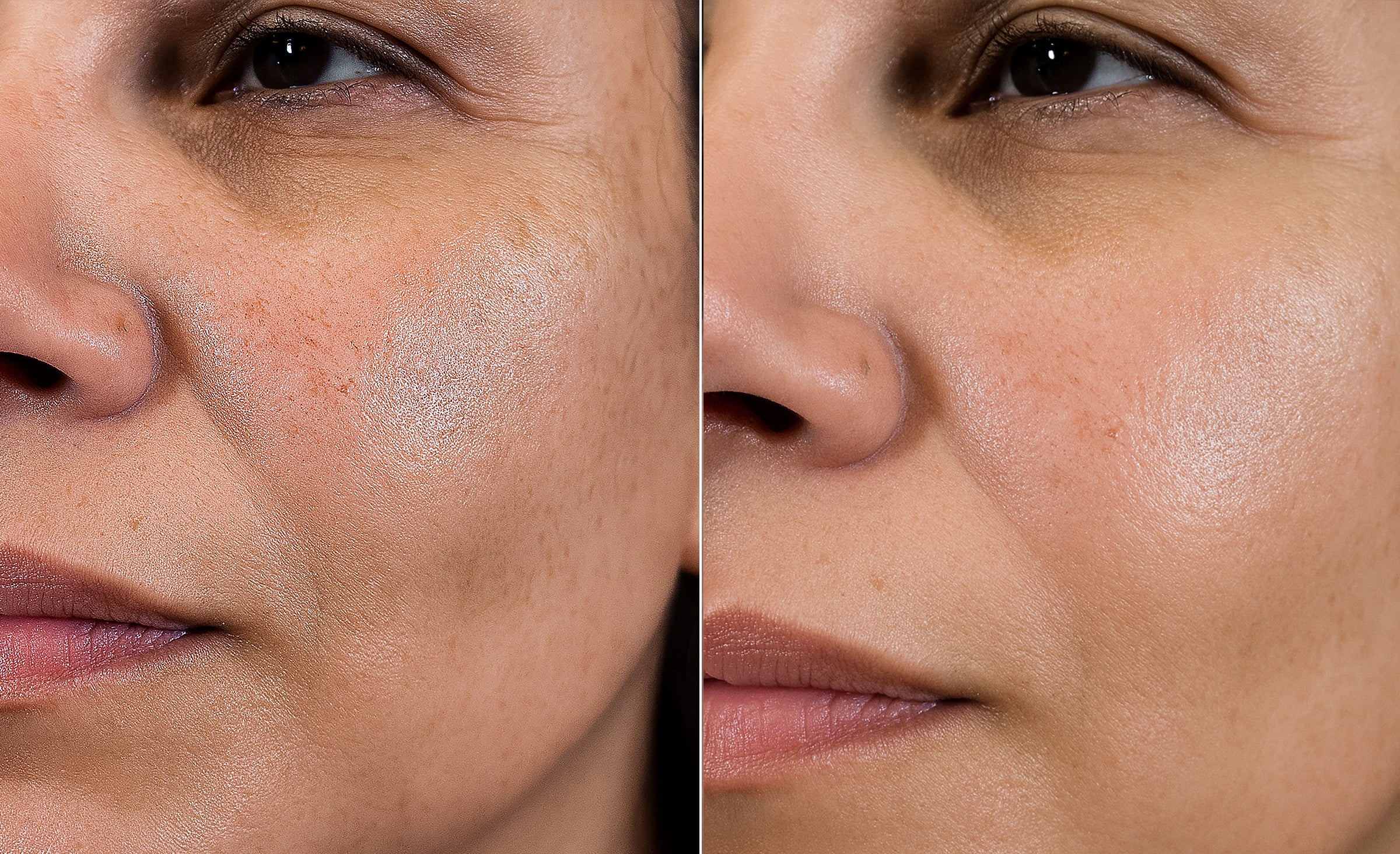 Split before/after